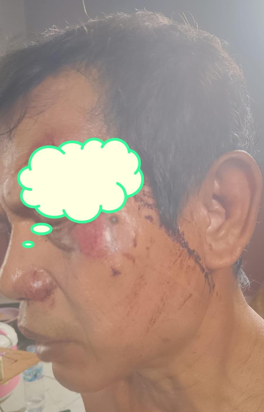 Sekelompok Preman Aniaya Warga di Daerah Pasar Rebo
